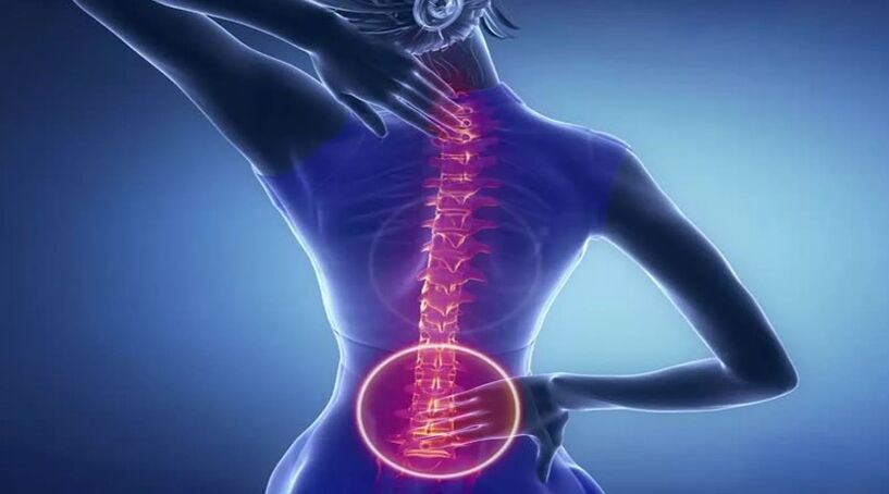 Spine osteochondrosis