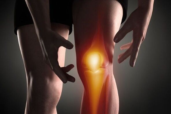 Knee articulation arthrosis