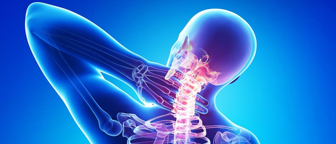 Cervical osteochondrosis is a pathological process in the column area