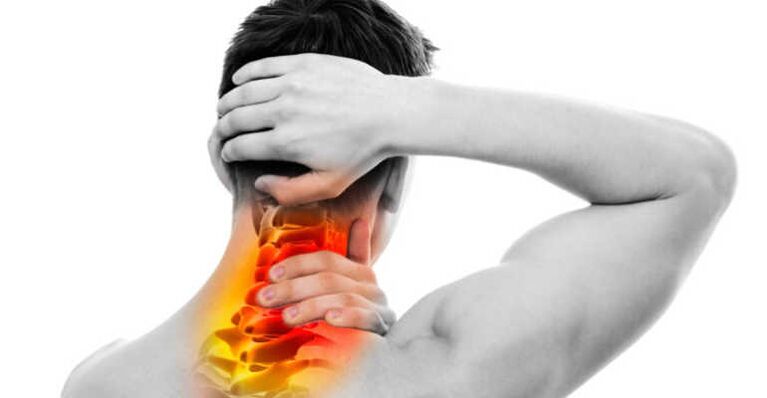 Neck pain and signs of osteochondrosis